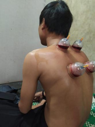 Keahlian Bekam Seorang Pemuda Jejeran 1